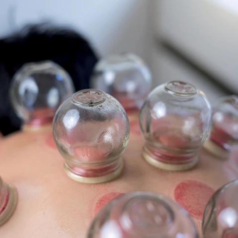 Opleiding T.Cupping - Syntra West